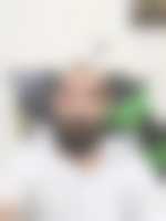 صورة العضو